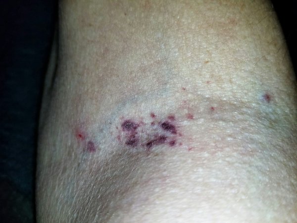 5 effets indésirables des crèmes anti-âge que vous devriez connaître